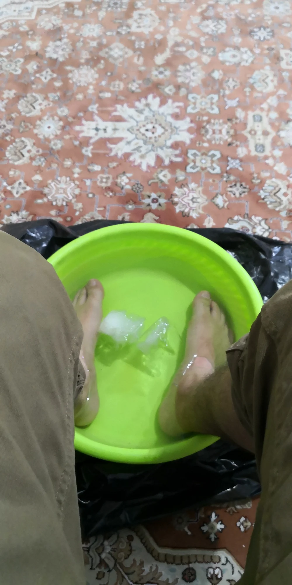 Swollen feet